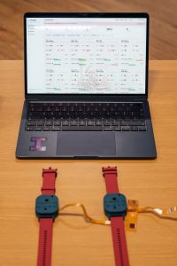 Two watch-style v3 prototypes in front of a laptop displaying the D-SCAPE clinical dashboard